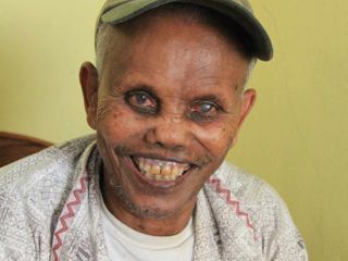 smiling-gentleman-after-korah-elders-leprosy-home-opens.jpg